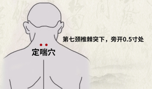 【穴位】:肺俞,定喘,脾俞,肾俞,天突.