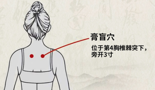 【穴位】:肺俞,大椎,风门,肾俞,膏肓俞,脾俞,定喘,丰隆及足三里【做法