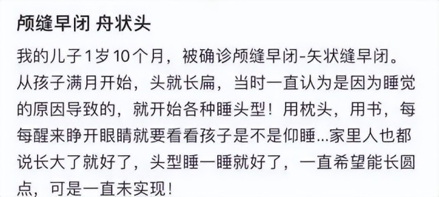 期間又因為疫情耽誤了幾個月,等去醫院時,醫生說是典型的舟狀頭,是顱