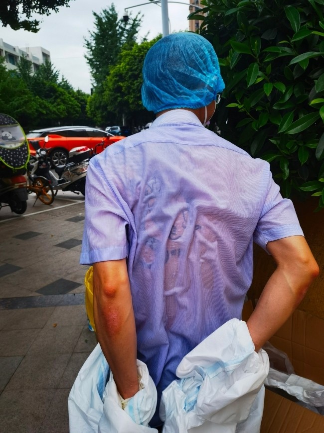 汗水,勒痕……他们脱下防护服瞬间 令人落泪_腾讯新闻