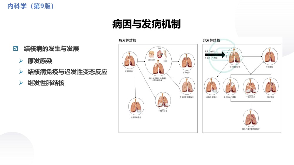 病原檢查方法及臨床重要性,抗結核的治療原則和方法需熟悉肺結核的