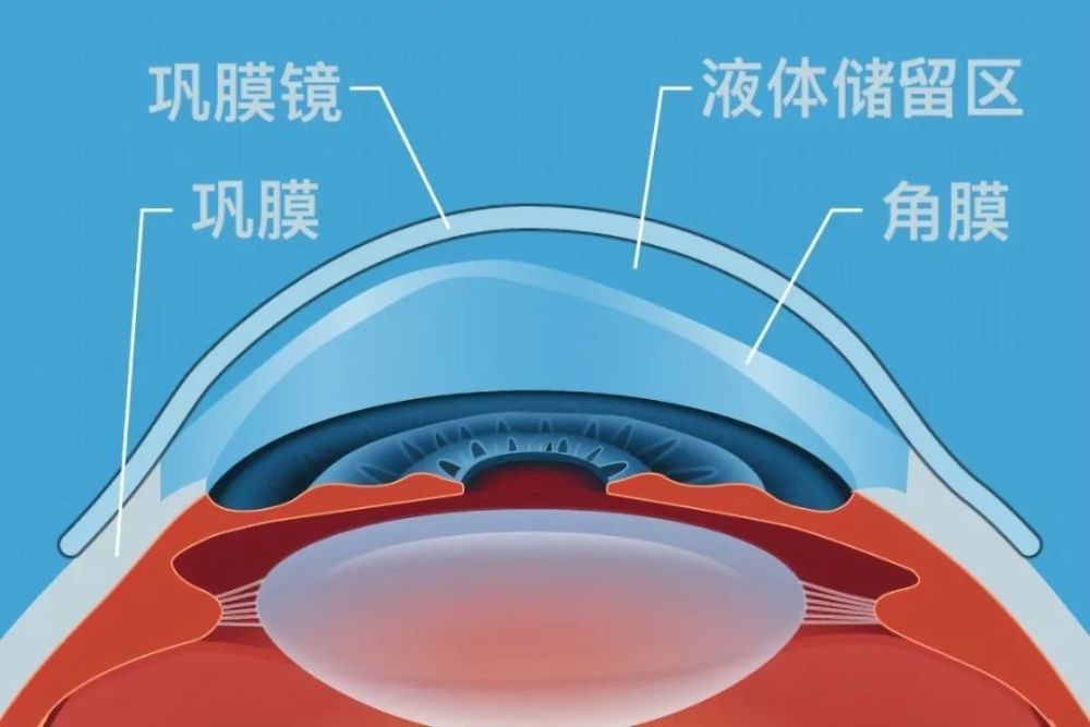 角膜高倍镜图片