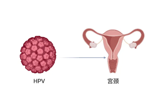 hpv感染|hpv|宫颈|医院