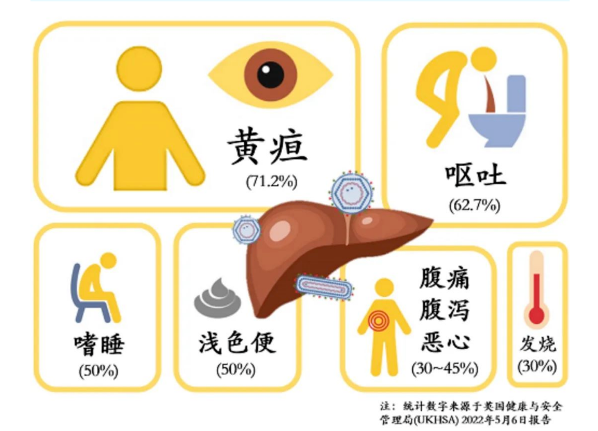 健康教育儿童病毒性肝炎知识您了解多少