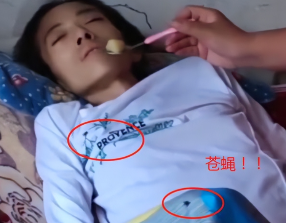 29岁小敏患癌后身上长蛆,资深护士称长期疏忽护理,丈夫却不认同