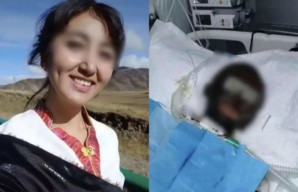 网红拉姆遭前夫烧伤致死罪犯被执行死刑