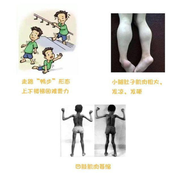 641