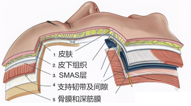 结构,从外至内分别为表皮,真皮,皮下脂肪,筋膜层(smas,肌肉层,骨膜层