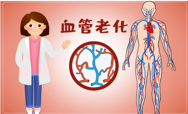 女性血管衰老更快？中医找到干预血管衰老新策略_腾讯新闻