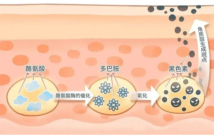 杭州艺星斑点是怎么形成的