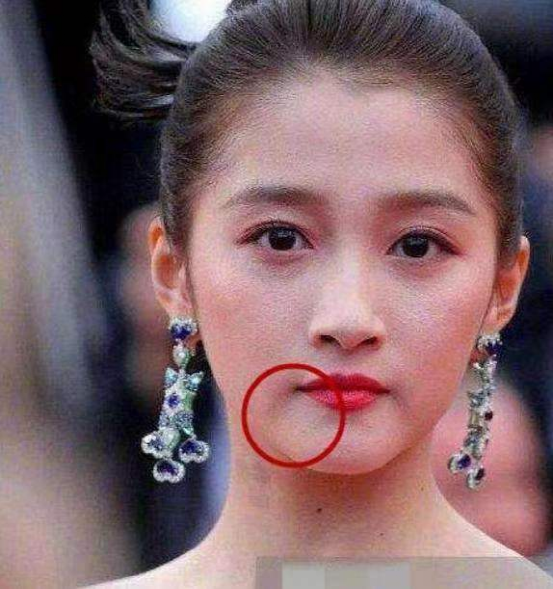 杨紫的法令纹关晓彤的木偶纹这些明星才20多岁却提前显老