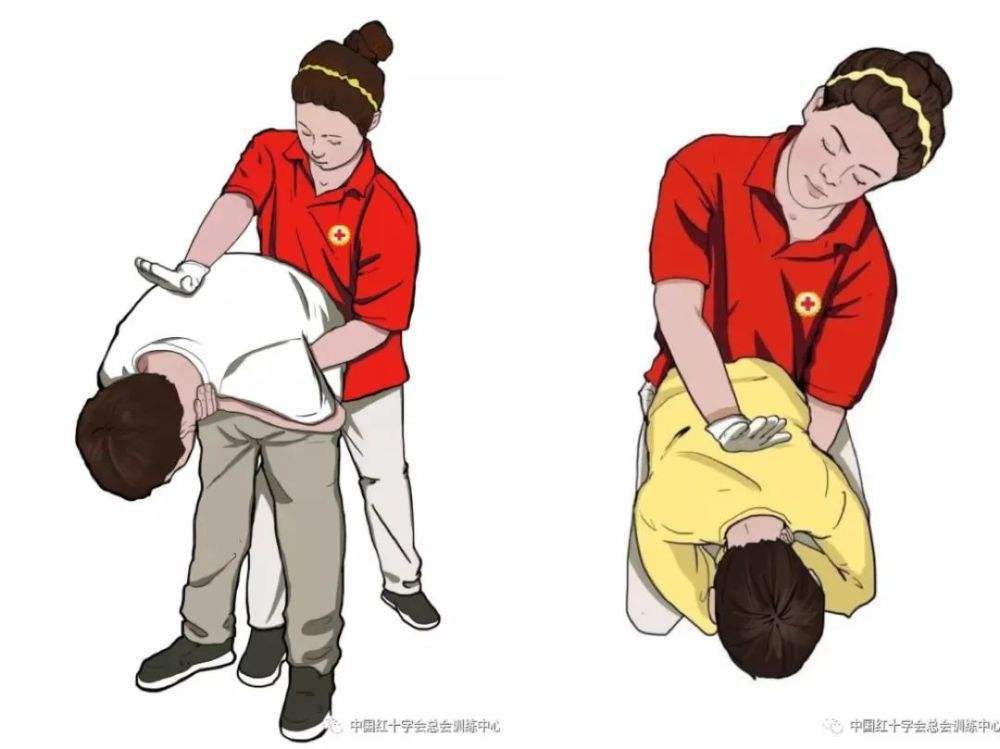 关于上一篇文章中所提到的海姆立克急救法和婴儿气道梗阻的补充