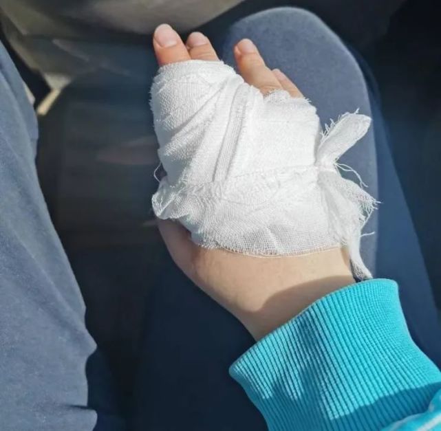 首"地说:"你这个伤口我们这里缝不了,我先给你做一个简单的消毒和包扎