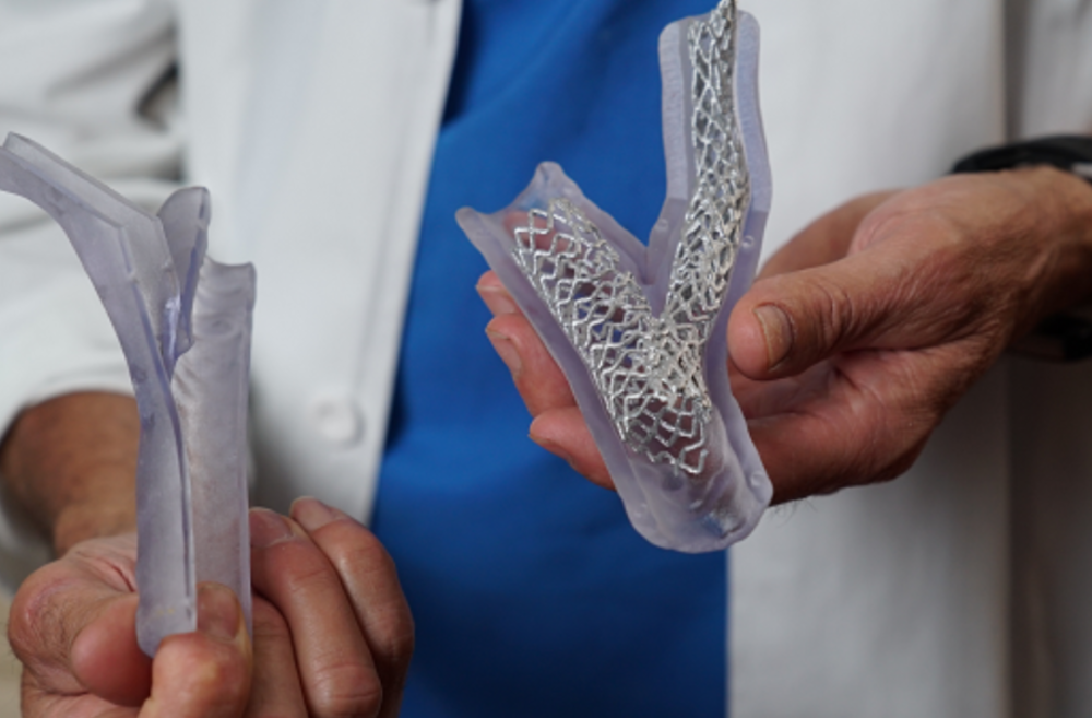 分析:3d打印如何助力医疗器械领域?_腾讯新闻