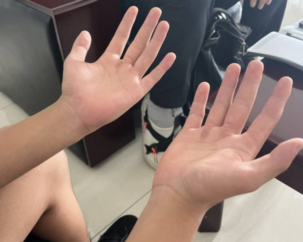 他搓着手说,像是想要把手上的痂都搓没了.