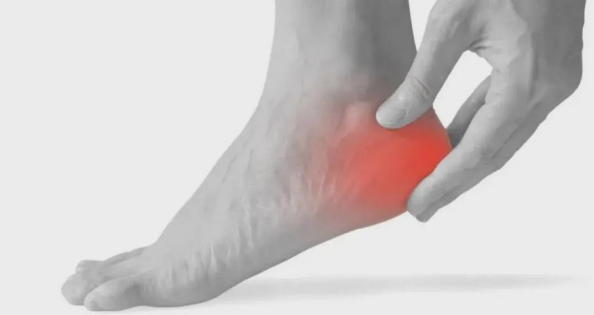 跟痛症,是足跟周围疼痛性疾病的总称,其发生时无明显外伤,但会影响