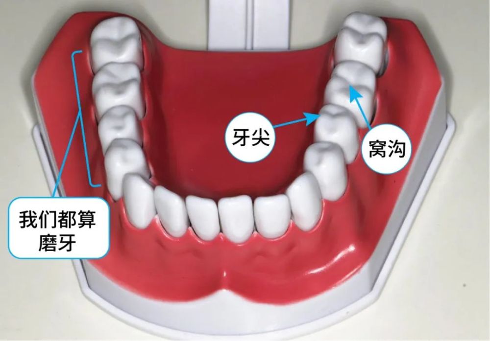 窝沟封闭是预防窝沟龋坏最有效的方法,你家小孩做了吗?_腾讯新闻