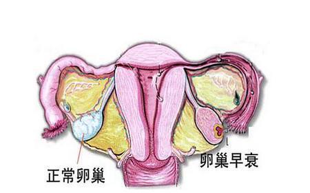 科普卵巢早衰班红霞主任有卵巢早衰可以怀孕吗