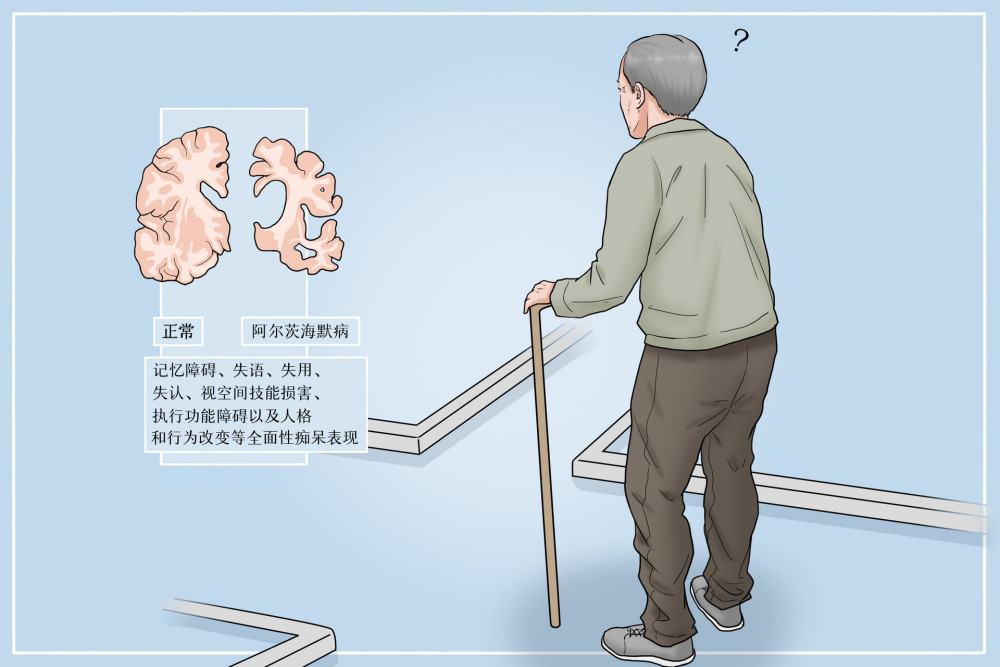 每3秒钟就有一位老人被诊断为老年痴呆