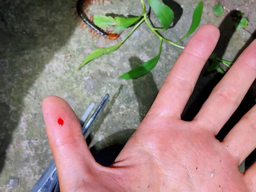 知名科普博主被巨型蜈蚣咬伤,半边身子灼烧与冰凉轮番上阵_腾讯新闻