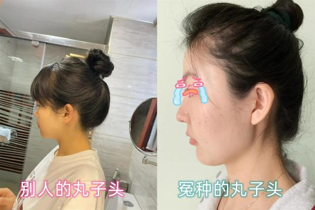 看到娱乐圈的“扁头族”，我终于治好了自己的精神内耗_腾讯新闻