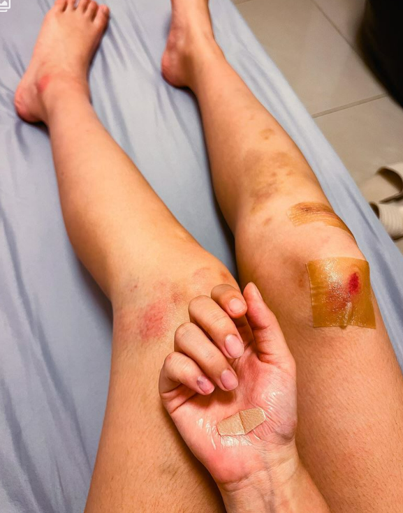 女主持杨净宇撞大货车受伤!