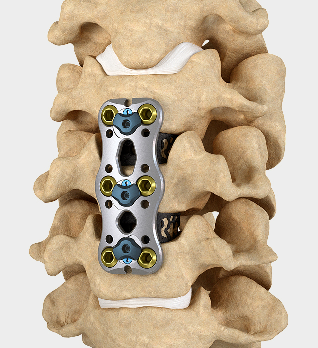 全球第三大脊柱公司换帅_腾讯新闻
