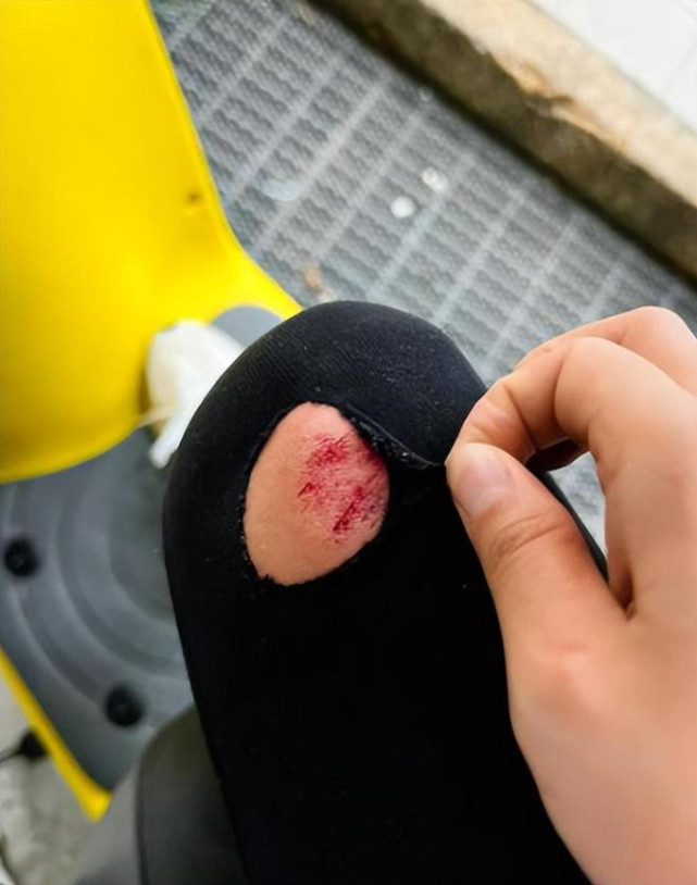 27岁女星杨净宇骑摩托出意外撞上大货车受伤裤子磨破伤口出血