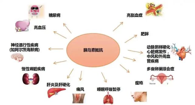 胰岛素生物学效应不足而引起,胰岛素抵抗贯穿整个病程并使糖尿病症状