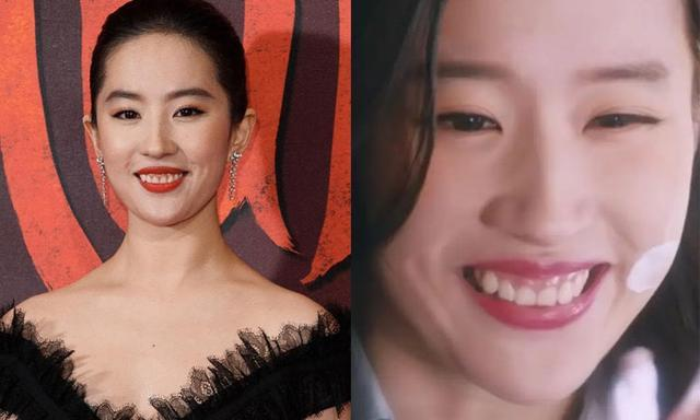 "露龈笑"才是颜值杀手,从刘亦菲到王俊凯,个个颜值"崩"_腾讯新闻