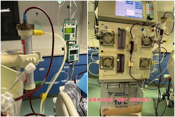 湘潭市三医院:"胡吃海喝"小心要"换血"