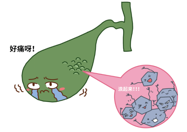 胆囊炎症与结石你最想知道的都在这了看完后赶紧收藏
