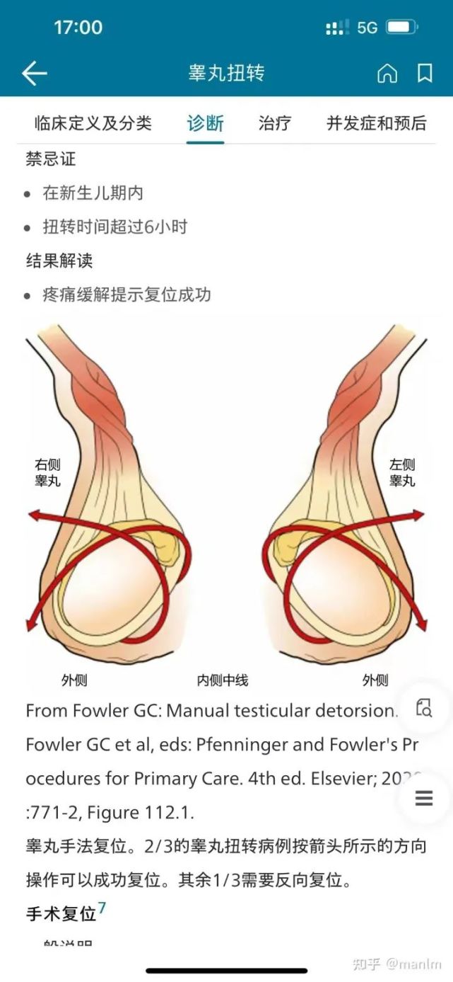 挤出睾丸方法手法图片