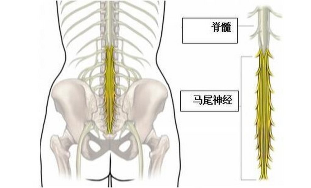 脊髓損傷和馬尾神經損傷有什麼關係?_騰訊新聞