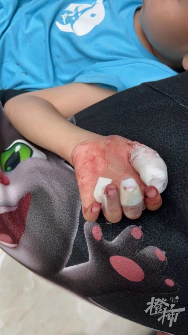 今天早上,该小区一位居民说,当时小孩子在河边玩耍,洗手,这条鱼上来就