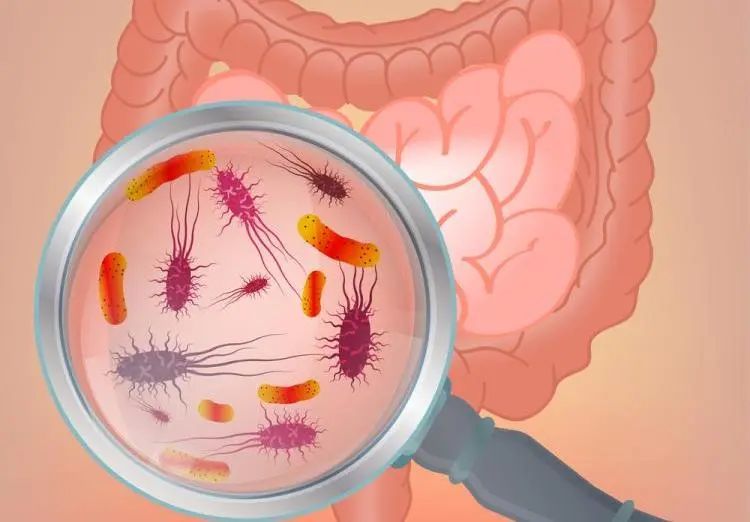 gut青年肠癌发病率翻倍复旦大学马延磊团队最新研究揭密