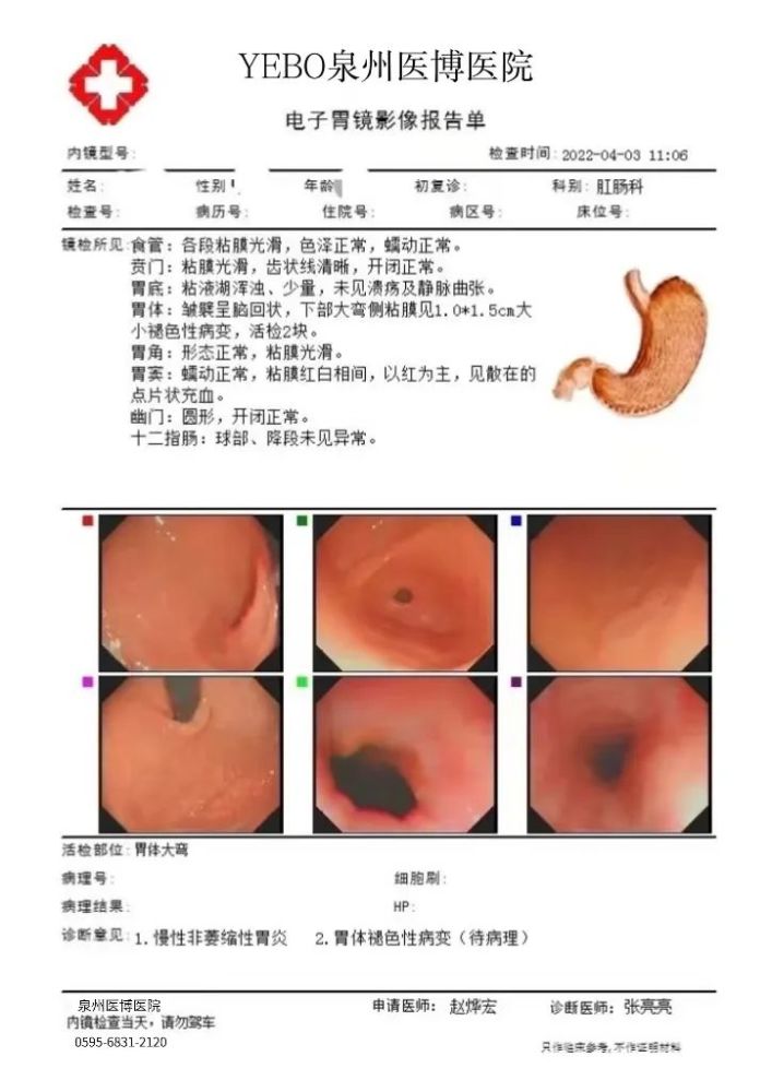 胃镜检查是诊断上消化道疾病主要的