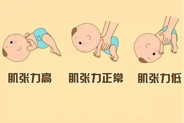 从医生建议肌张力高的宝宝多游泳看宝宝游泳的好处
