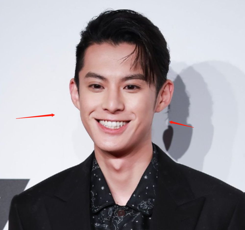 王鹤棣走红前生图曝光,嘴歪大小眼明显,惨被网友吐槽难看_腾讯新闻