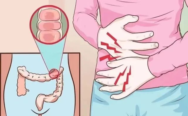 换季出现肠道不适?肠道疾病早期筛查重要又关键