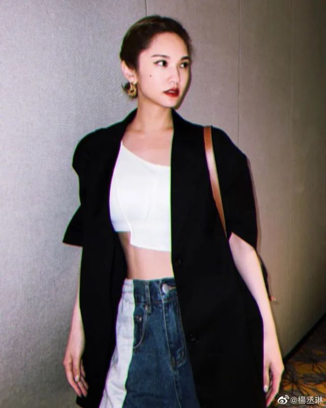 安崎的媒婆痣,切掉可惜吗?