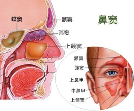 要及時去醫院找兒科或專業醫生診治:1,經常流鼻涕,尤其黃綠色膿涕;2