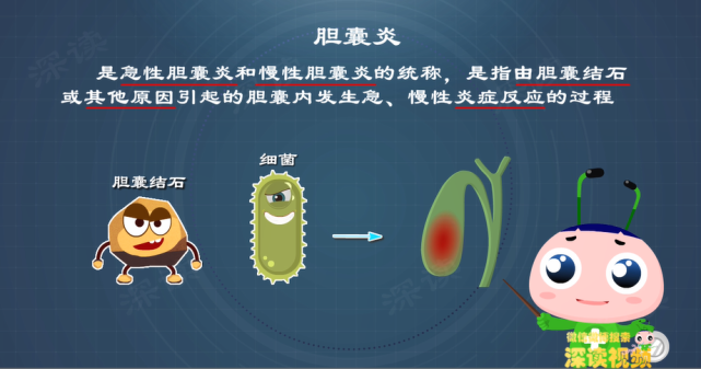 急性胆囊炎图片图片