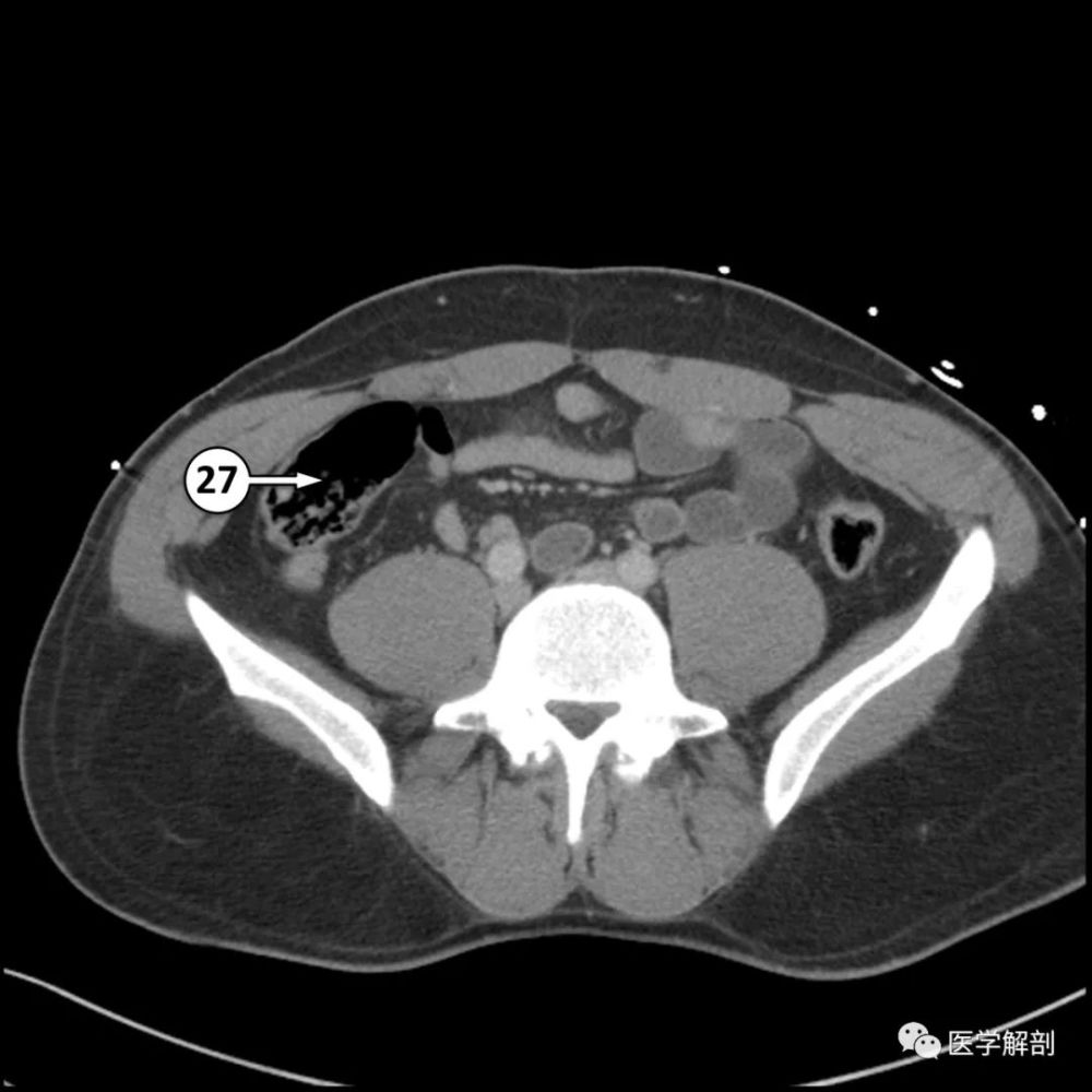 5分鐘看完這篇學會全腹ct解剖