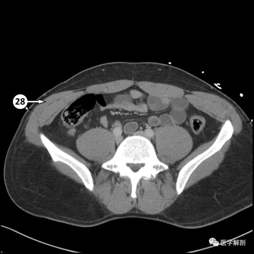 5分钟看完这篇学会全腹ct解剖