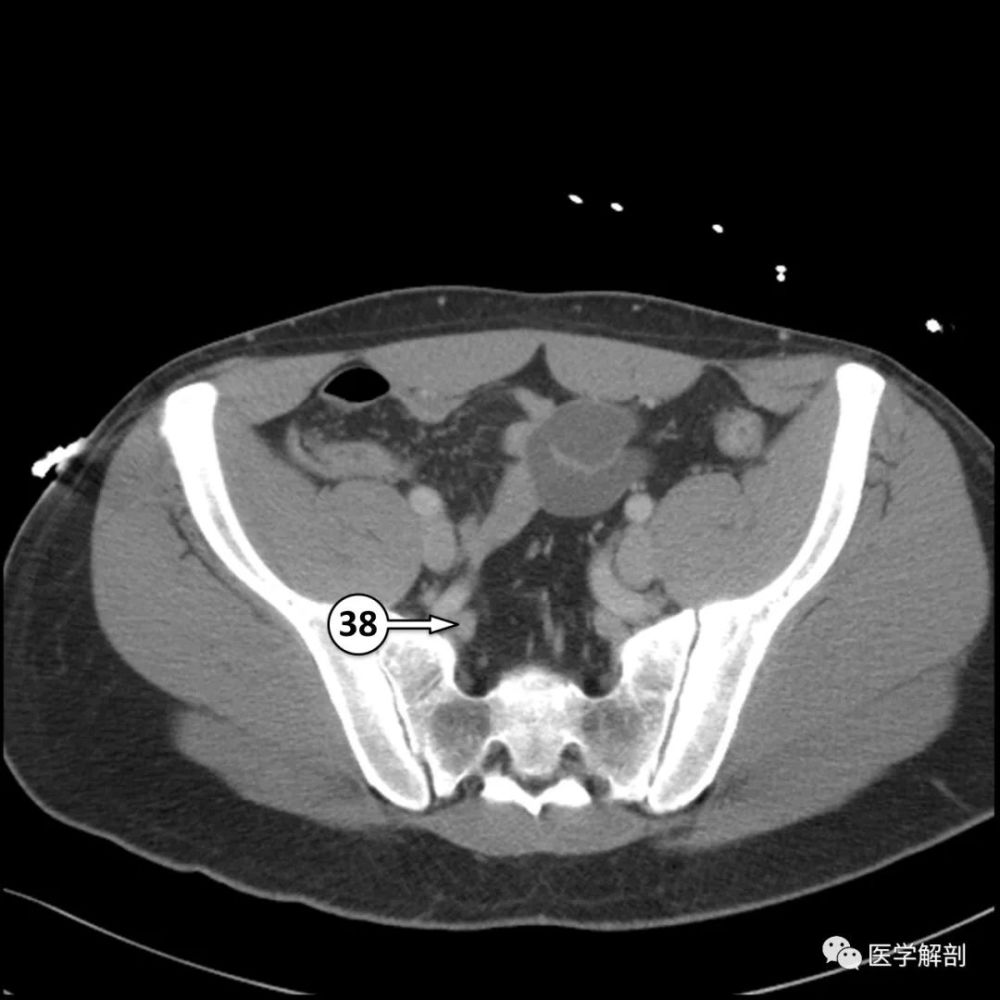 5分鐘看完這篇學會全腹ct解剖