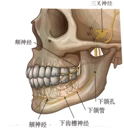 张立天颌面课堂做完下颌角磨骨手术嘴变歪怎么回事