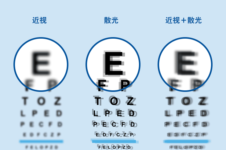 如何判斷是否自己是否散光【測試方法】摘掉眼鏡,手持手機與眼睛同高