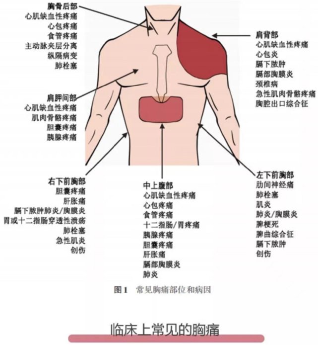 要如何来区分,我们可以从下图学习,这张图可以教会我们从疼痛部位找