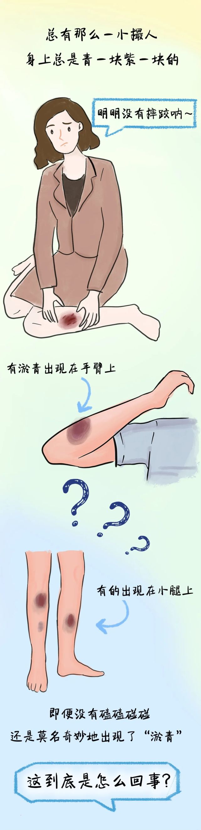 当心突然出现的淤青!